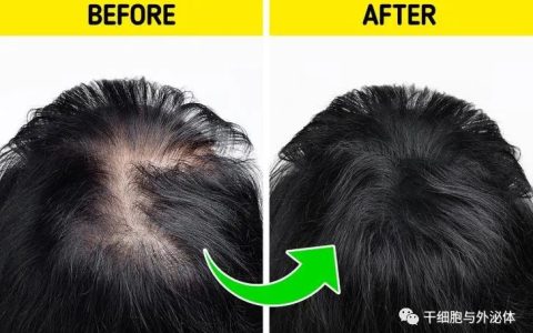 脱发新疗法 | 头发再生的关键存在于外泌体miRNA中