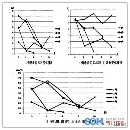 重庆医学：脐带间充质干细胞输注治疗4例类风湿关节炎的临床研究