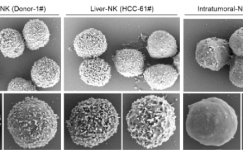 中科大发现NK细胞失去抗肿瘤能力关键机制