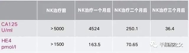 卵巢癌晚期多发转移，NK细胞疗法帮她实现长期生存