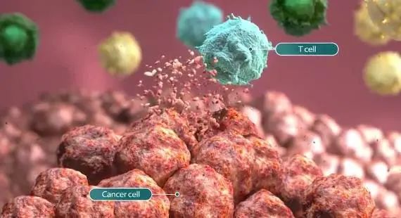 癌症化疗效果不明显？细胞免疫疗法联合化疗，更好的抗肿瘤疗效