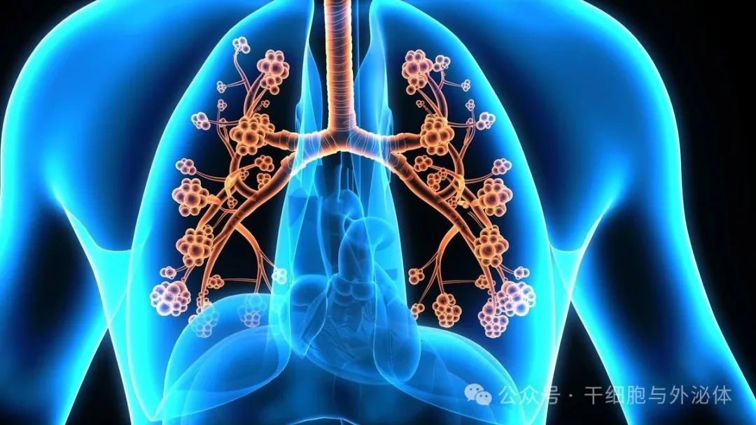 患者4500万，间充质干细胞移植可有效减轻哮喘发病率