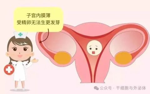 不孕症新突破：18例薄型子宫内膜患者移植间充质干细胞，成功怀孕