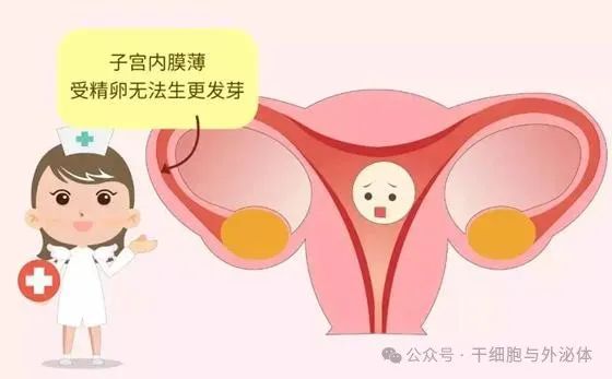 不孕症新突破：18例薄型子宫内膜患者移植间充质干细胞，成功怀孕