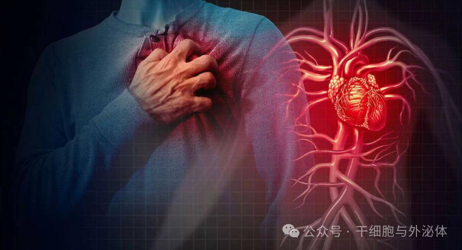 565例证明，移植间充质前体细胞使心肌梗死或脑卒中的风险降低75%