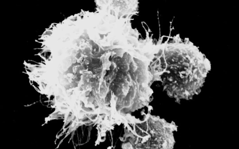 免疫细胞NK细胞和CIK细胞，你知道区别吗？