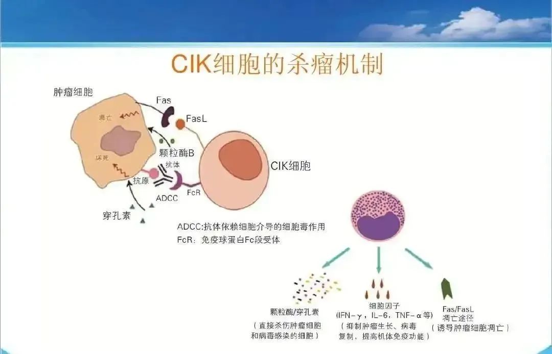 CIK细胞疗法