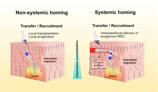 干细胞给药途径之间有何差异？为什么静脉回输最受青睐？