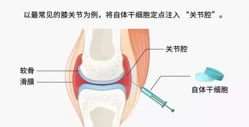 2024欧洲杯：39岁C罗上榜，保持状态的秘密武器竟然是干细胞