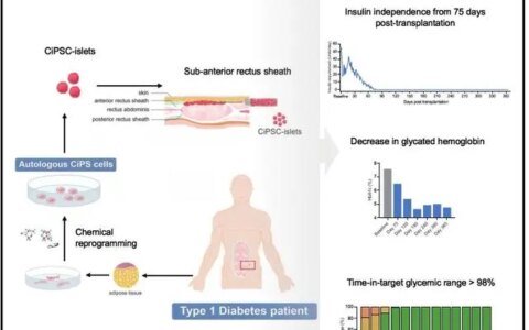 重磅！​我国科学家首次利用干细胞再生疗法功能性治愈1型糖尿病