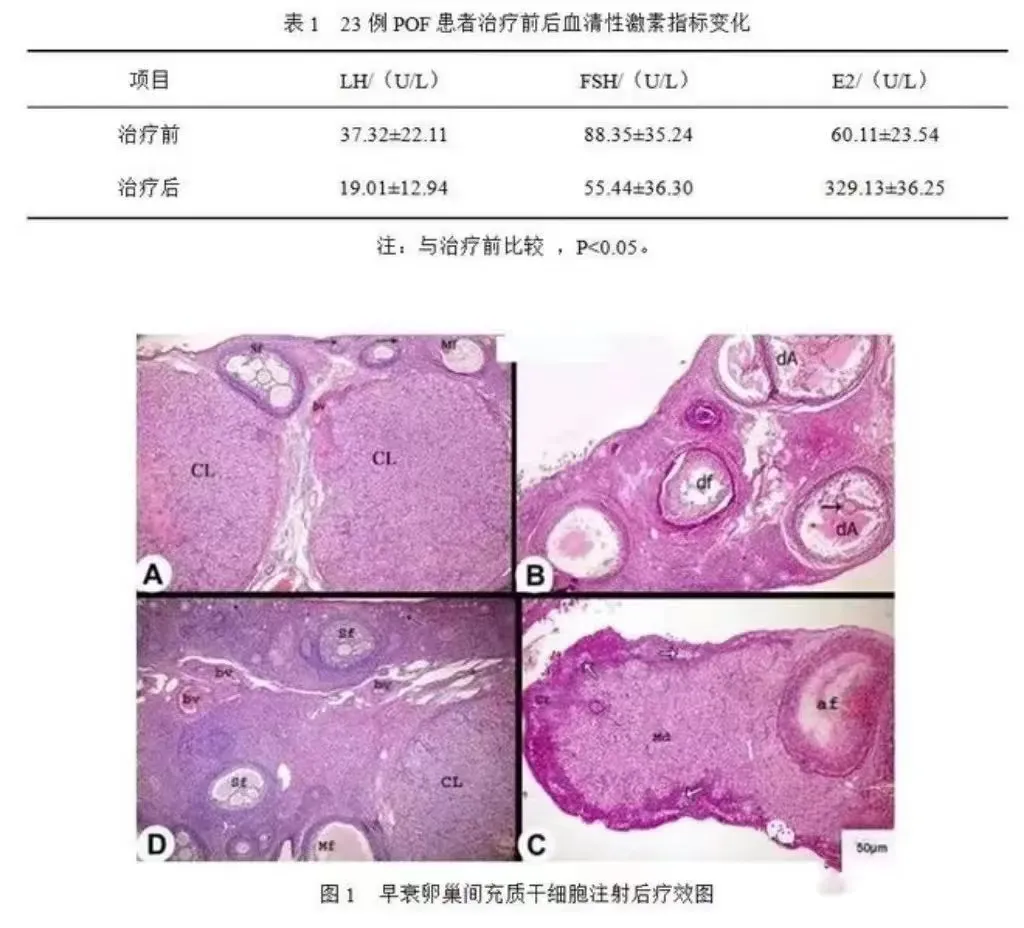 临床案例｜干细胞治愈卵巢早衰！痊愈10例，有效治疗13例，成功率高达92％