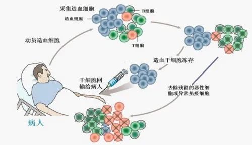 细胞科普 | 偏瘫治疗新路径：干细胞的神奇力量