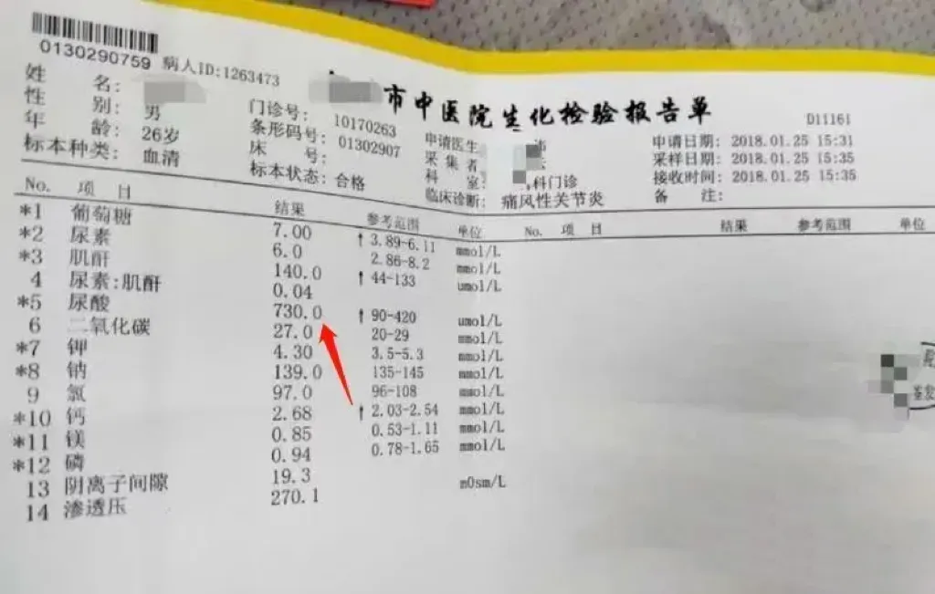 细胞科普 | 痛风有救了：干细胞疗法显著提升尿酸控制，缓解关节炎症